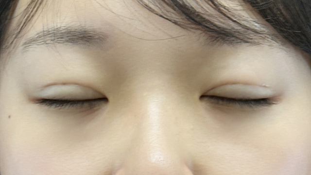 Postoperative Condition Part 1