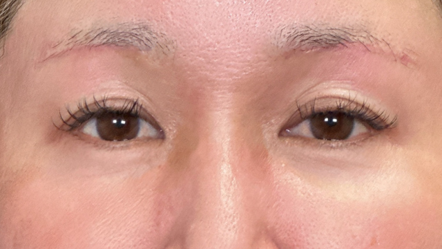 Postoperative Condition Part 1