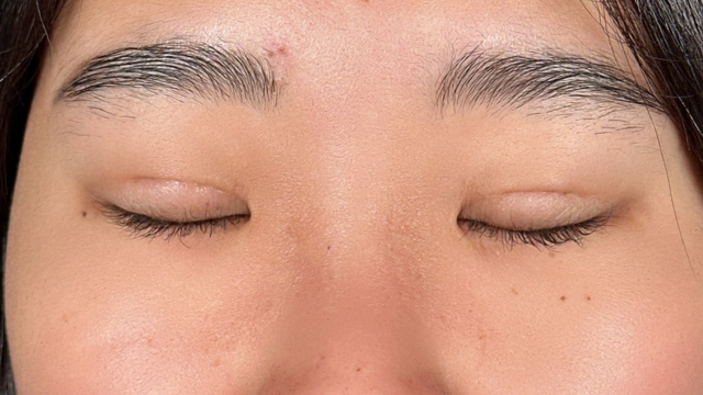 Postoperative Condition Part 1