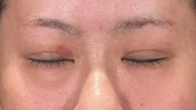 Postoperative Condition Part 1