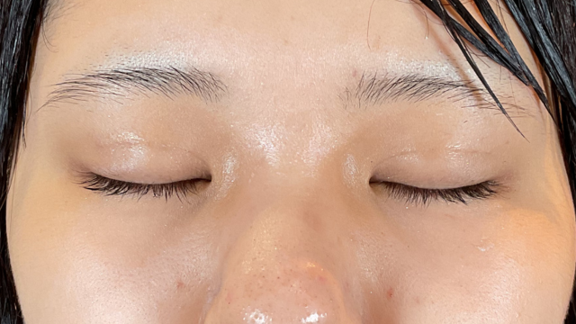 Postoperative Condition Part 1