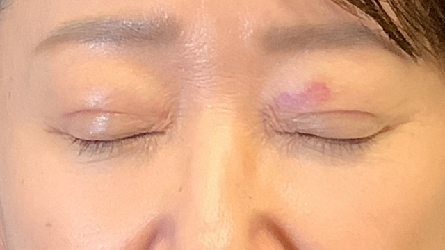 Postoperative Condition Part 1