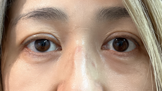 Postoperative Condition Part 1