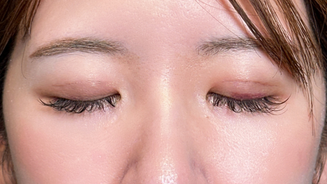 Postoperative Condition Part 1