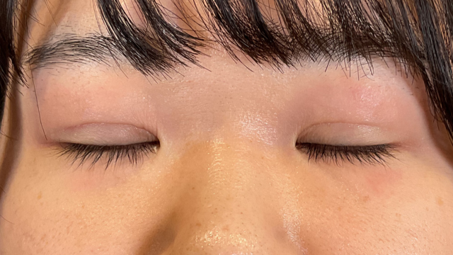 Postoperative Condition Part 1