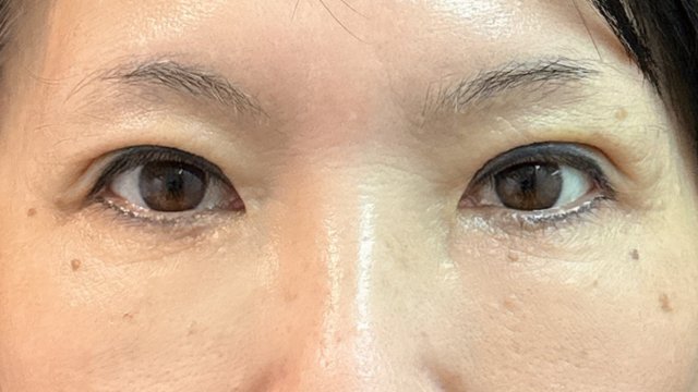 Postoperative Condition Part 1