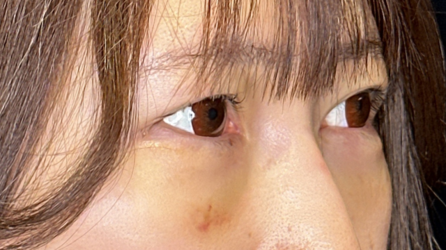 Postoperative Condition Part 1