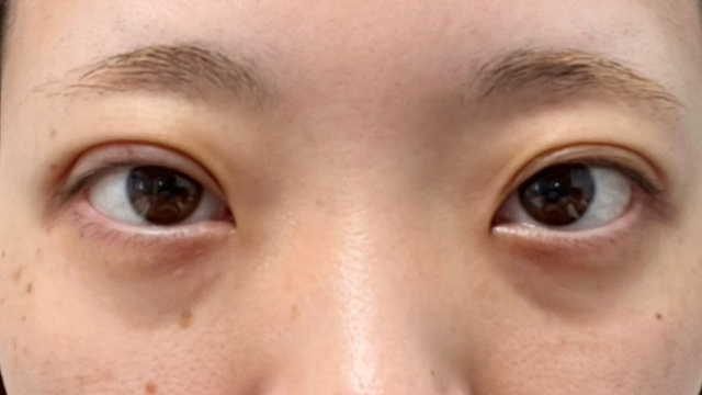 Postoperative Condition Part 1