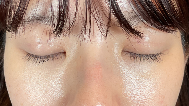 Postoperative Condition Part 1