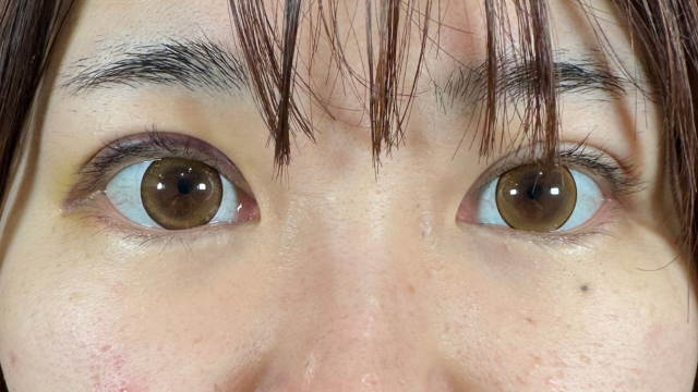 Postoperative Condition Part 1