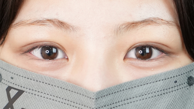 手术前的状态 其一