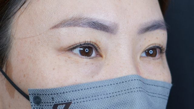 Postoperative Condition Part 1