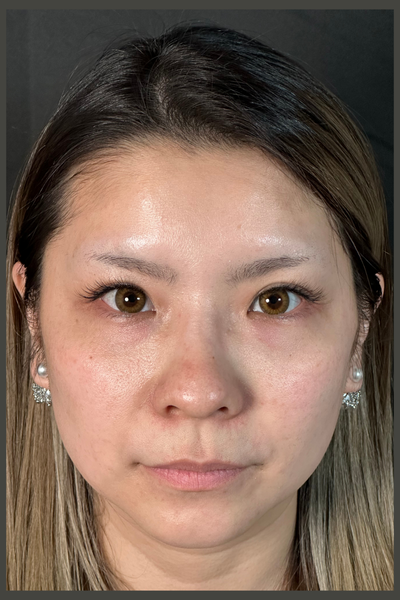 手術前の状態 その1