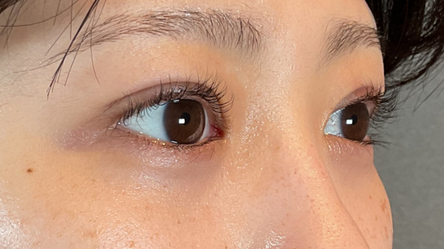 Postoperative Condition Part 1