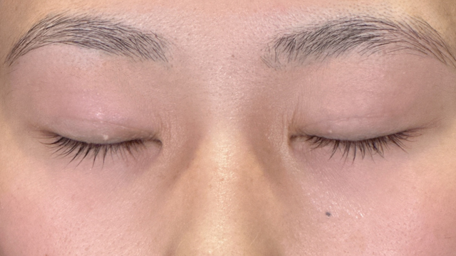 Postoperative Condition Part 1