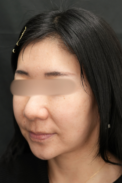 Postoperative Condition Part 1