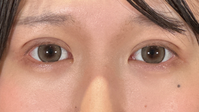 Postoperative Condition Part 1