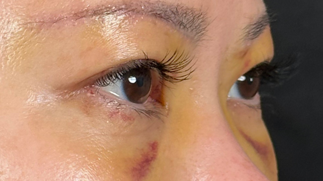 Postoperative Condition Part 1