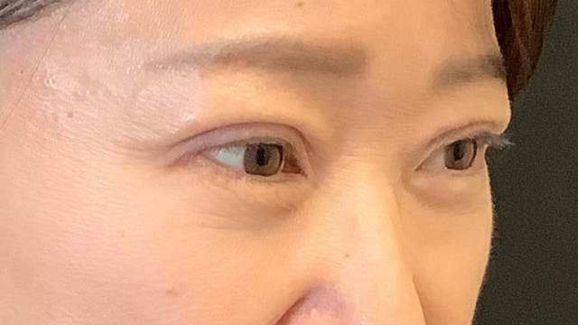 Postoperative Condition Part 1