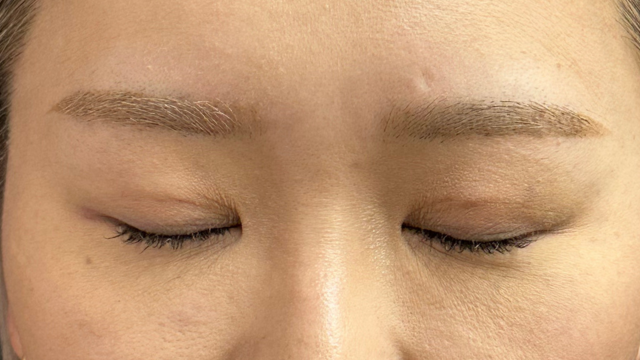 Postoperative Condition Part 1