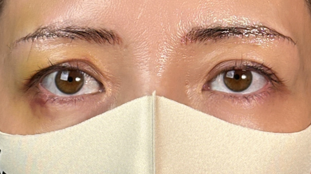 Postoperative Condition Part 1