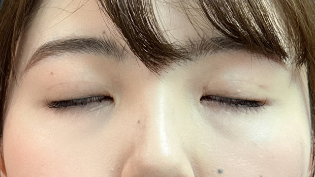 Postoperative Condition Part 1