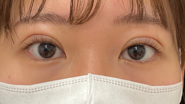 Postoperative Condition Part 1