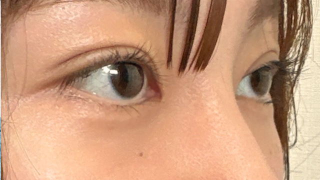 Postoperative Condition Part 1