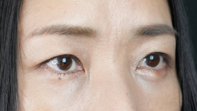 Postoperative Condition Part 1