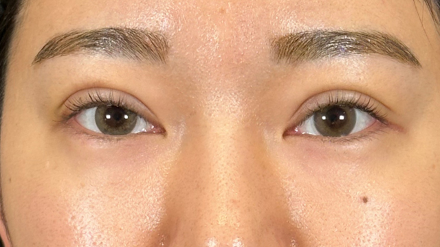 Postoperative Condition Part 1