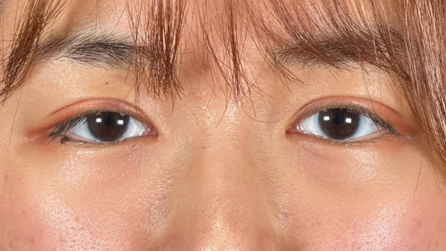 Postoperative Condition Part 1