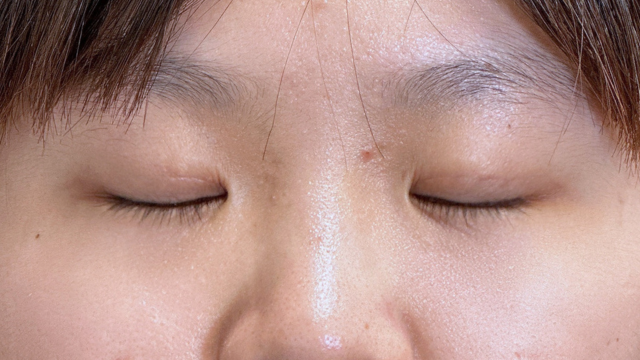 Postoperative Condition Part 1