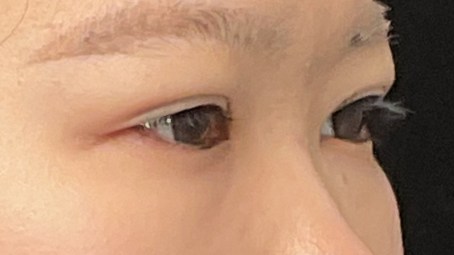 Postoperative Condition Part 1