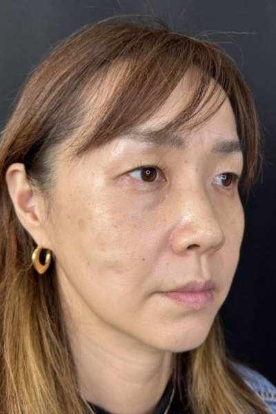 Postoperative Condition Part 1