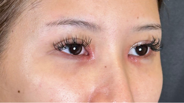 Postoperative Condition Part 1