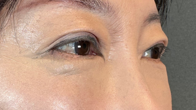 Postoperative Condition Part 1