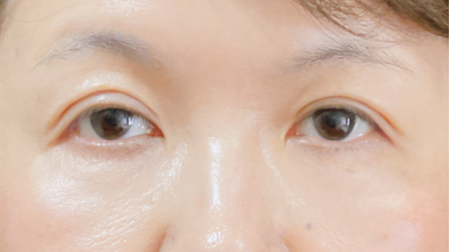 Postoperative Condition Part 1