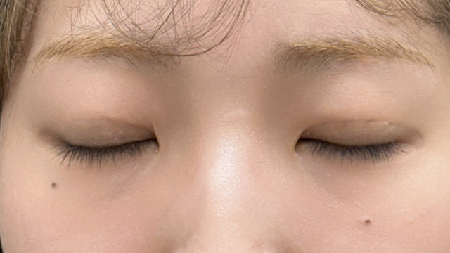 Postoperative Condition Part 1