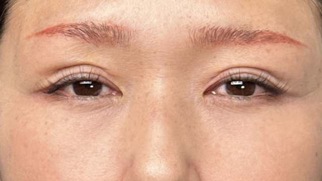 Postoperative Condition Part 1