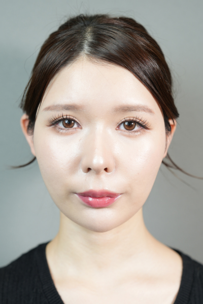 Postoperative Condition Part 1