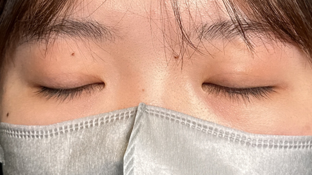 Postoperative Condition Part 1