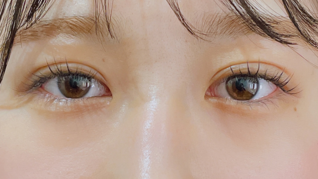 Postoperative Condition Part 1