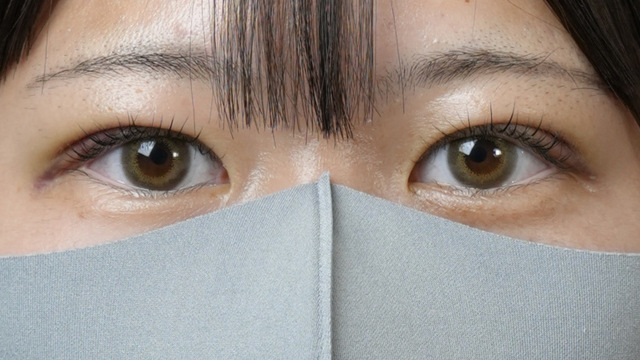 Postoperative Condition Part 1