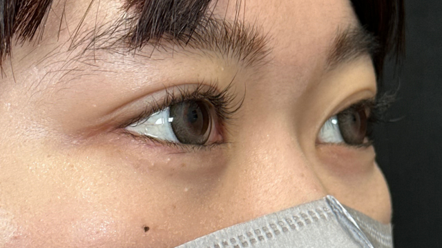 Postoperative Condition Part 1