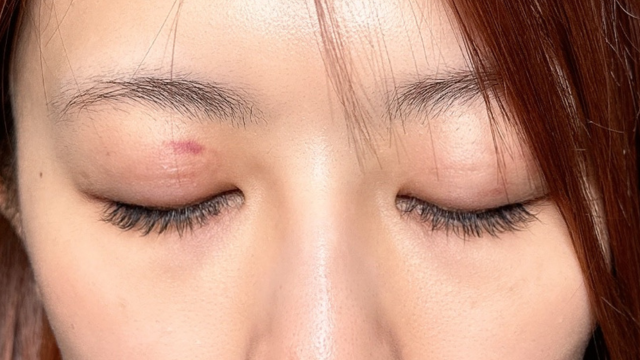 Postoperative Condition Part 1