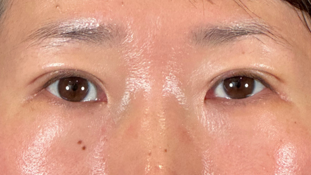 Postoperative Condition Part 1