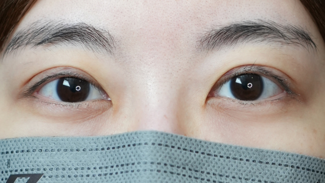 Postoperative Condition Part 1