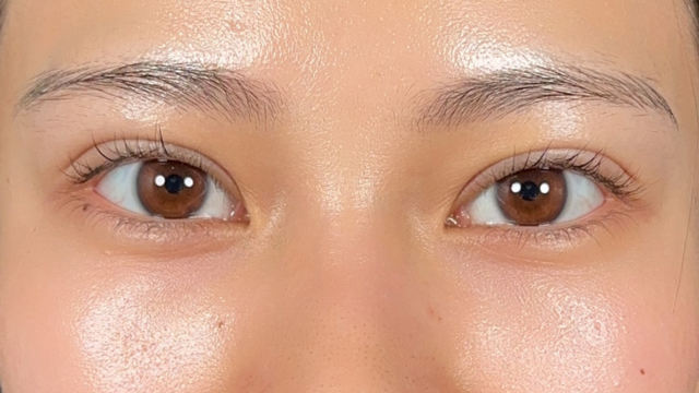 Postoperative Condition Part 1