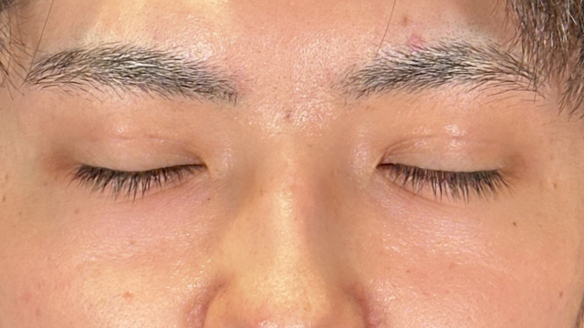 Postoperative Condition Part 1