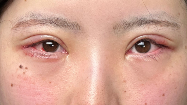 Postoperative Condition Part 1